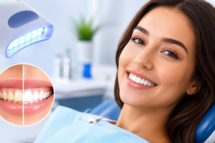 Teeth Whitening