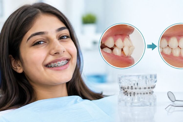 Orthodontic Treatment